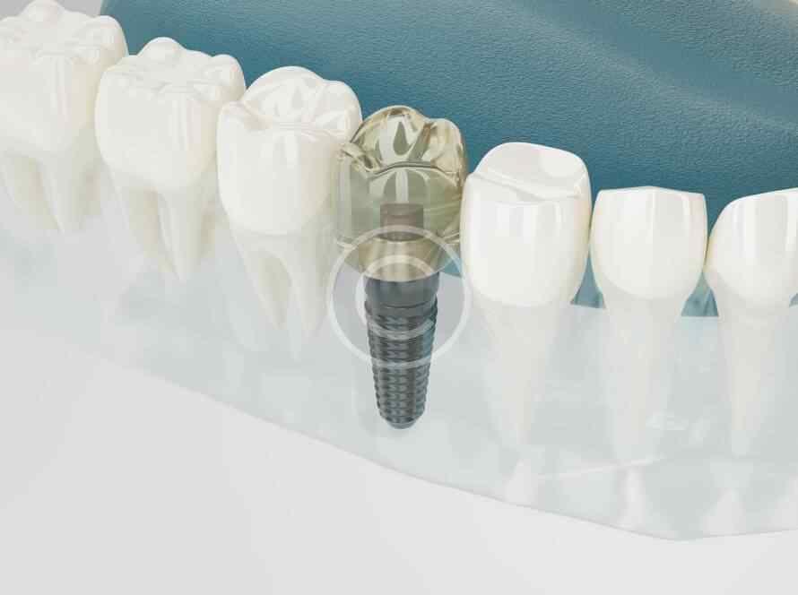 custom image 035 copyright